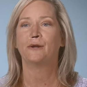 Robert Barron and patient Laura Schild appeared on "Botched